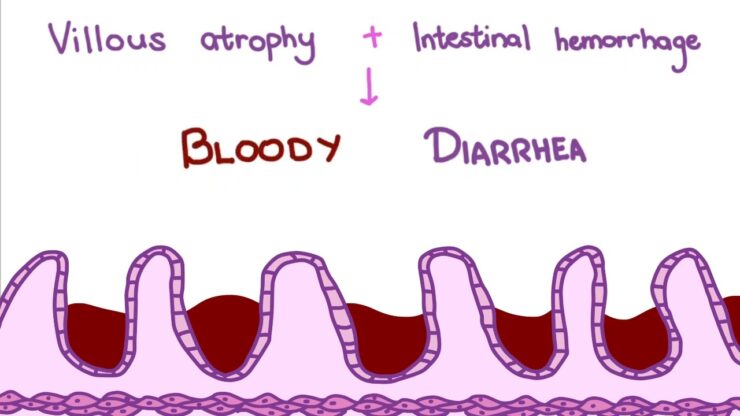 Parvovirus