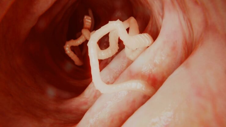 Tapeworms