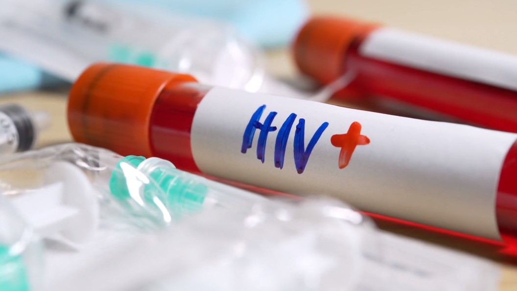 Is HIV The Deadliest Virus Ever